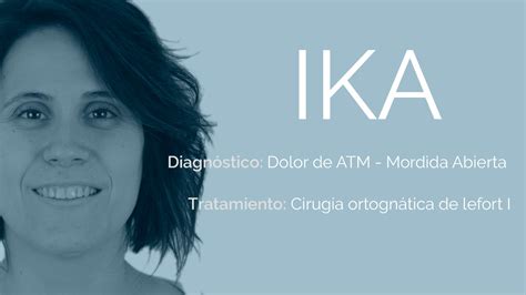 ICOMF Cirugía Oral y Maxilofacial – Especialistas en Cirugía .